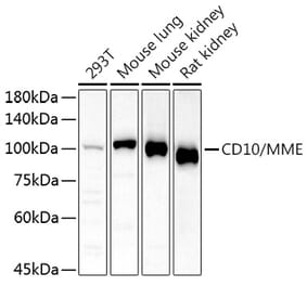 Western Blot - Anti-CD10 Antibody (A14892) - Antibodies.com