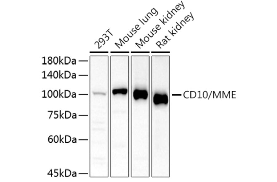 Western Blot - Anti-CD10 Antibody (A14892) - Antibodies.com