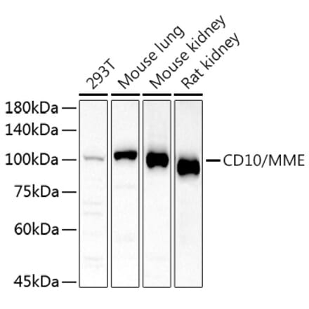 Western Blot - Anti-CD10 Antibody (A14892) - Antibodies.com