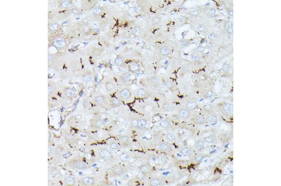 Immunohistochemistry - Anti-CD10 Antibody (A14892) - Antibodies.com