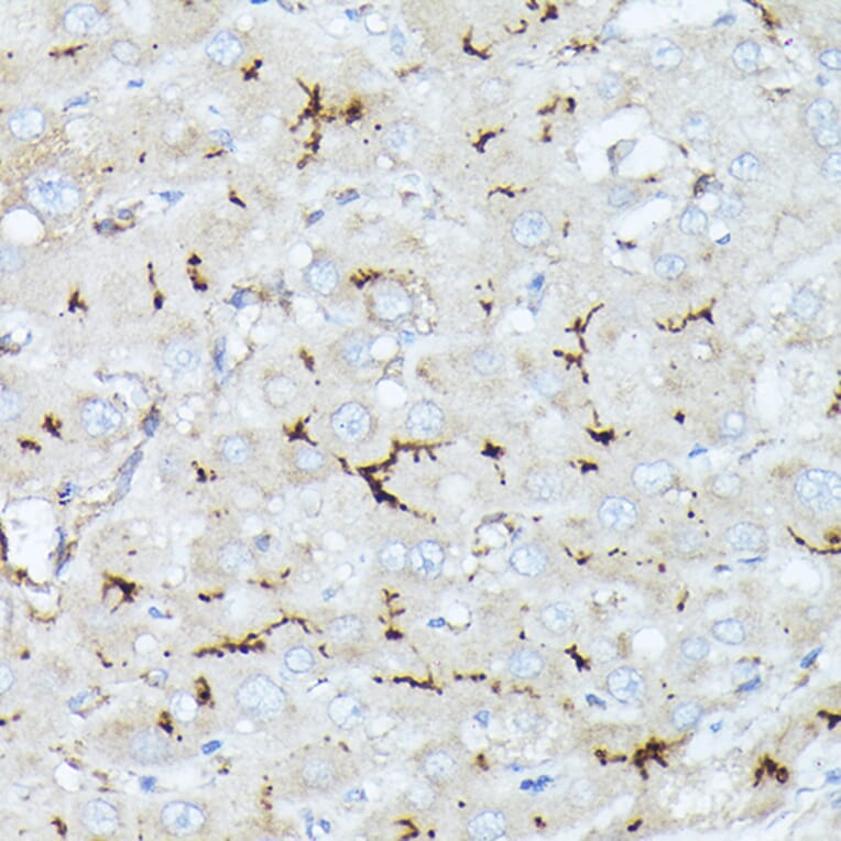 Immunohistochemistry - Anti-CD10 Antibody (A14892) - Antibodies.com
