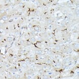 Immunohistochemistry - Anti-CD10 Antibody (A14892) - Antibodies.com