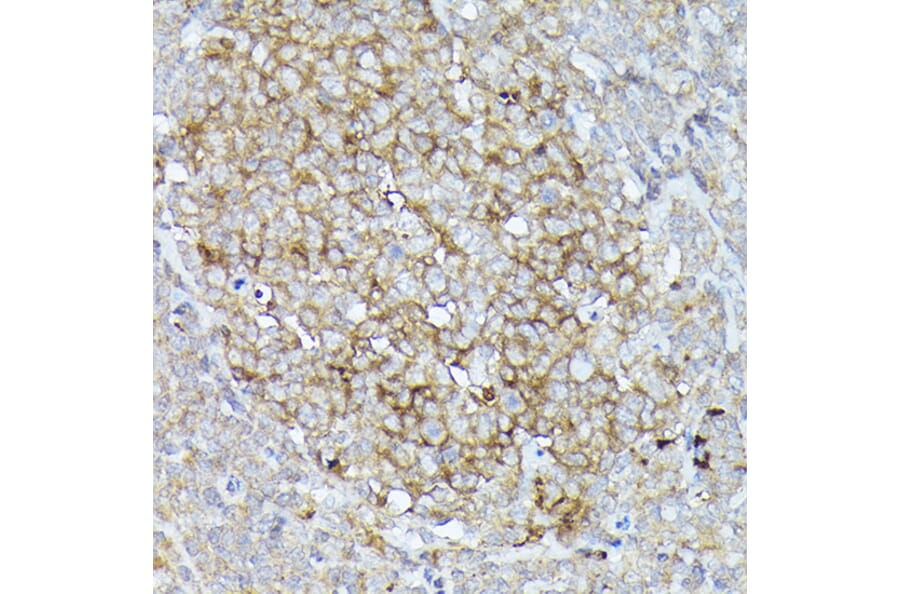 Immunohistochemistry - Anti-CD10 Antibody (A14892) - Antibodies.com