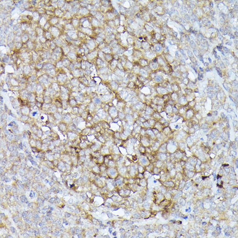 Immunohistochemistry - Anti-CD10 Antibody (A14892) - Antibodies.com