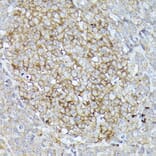Immunohistochemistry - Anti-CD10 Antibody (A14892) - Antibodies.com