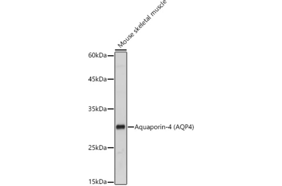 Western Blot - Anti-Aquaporin 4 Antibody (A14893) - Antibodies.com
