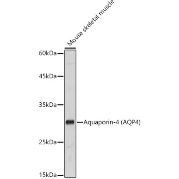 Western Blot - Anti-Aquaporin 4 Antibody (A14893) - Antibodies.com