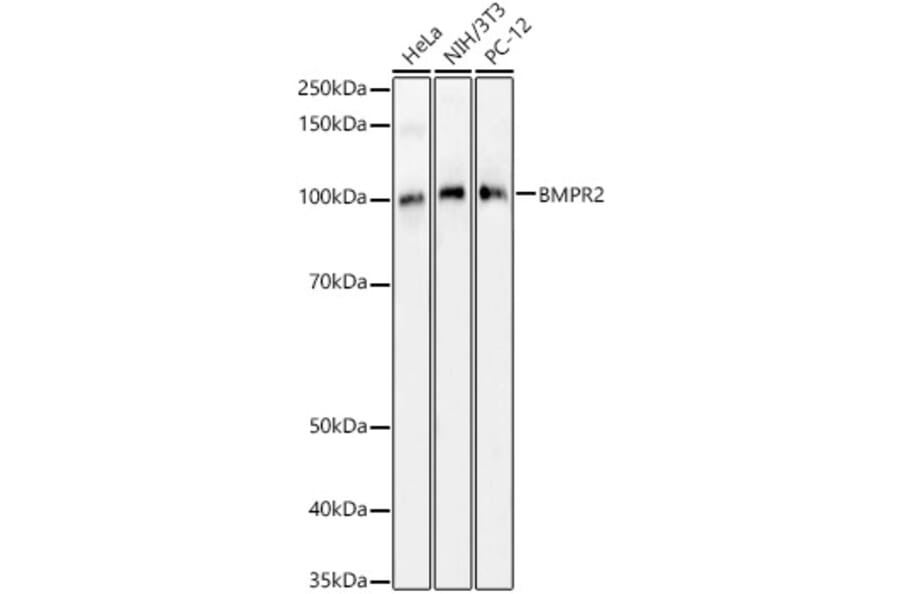 Western Blot - Anti-BMPR2 Antibody (A14894) - Antibodies.com