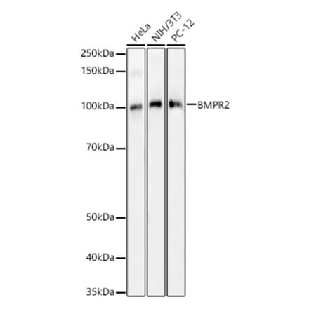 Western Blot - Anti-BMPR2 Antibody (A14894) - Antibodies.com