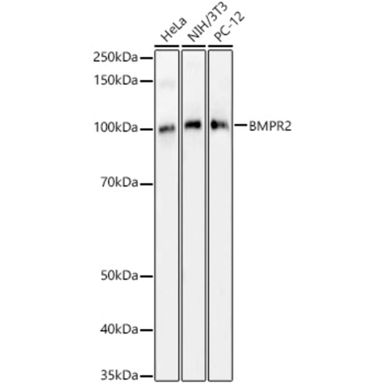 Western Blot - Anti-BMPR2 Antibody (A14894) - Antibodies.com