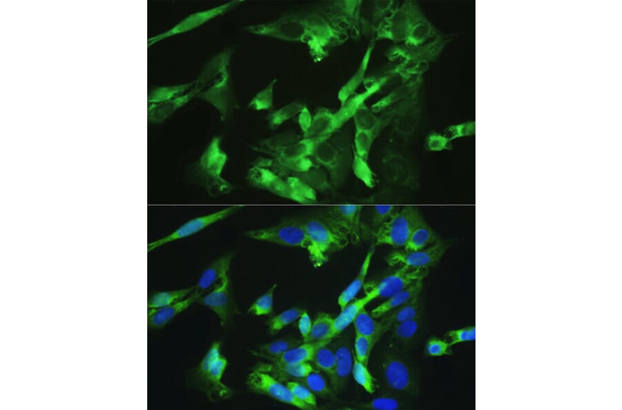 Immunofluorescence - Anti-BMPR2 Antibody (A14894) - Antibodies.com
