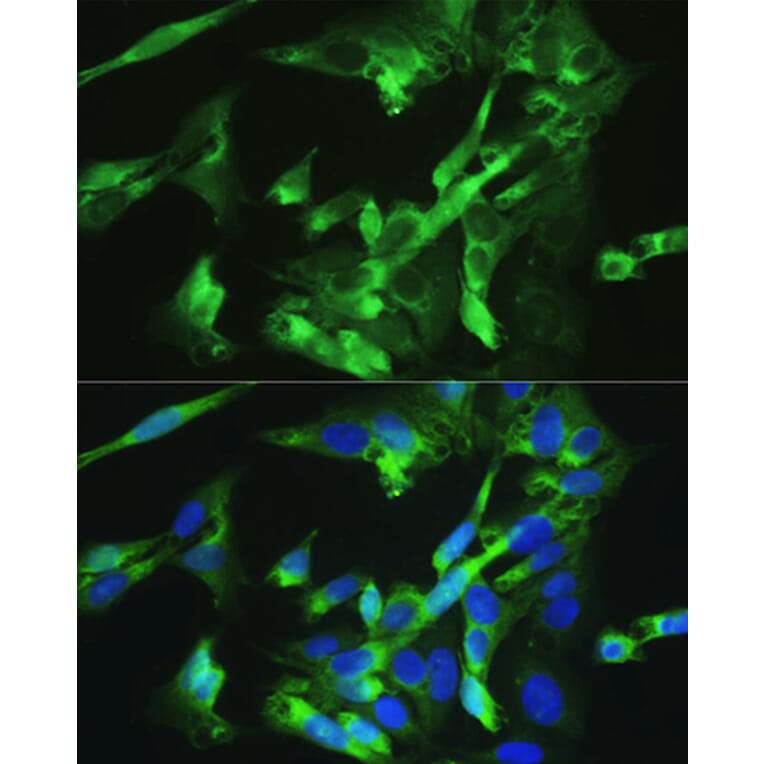 Immunofluorescence - Anti-BMPR2 Antibody (A14894) - Antibodies.com