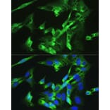 Immunofluorescence - Anti-BMPR2 Antibody (A14894) - Antibodies.com