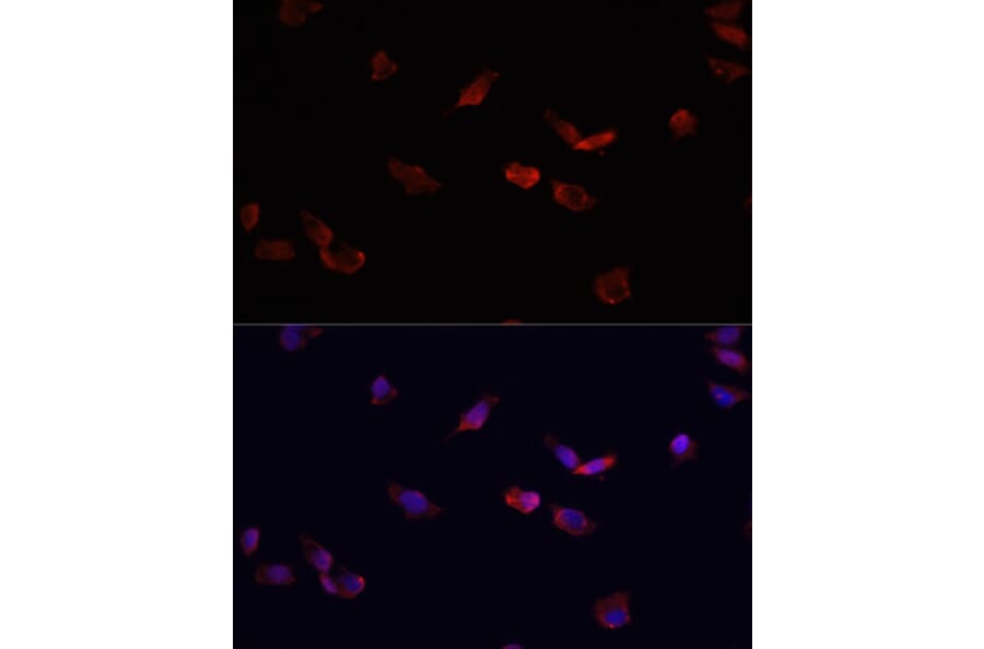 Immunofluorescence - Anti-BMPR2 Antibody (A14894) - Antibodies.com