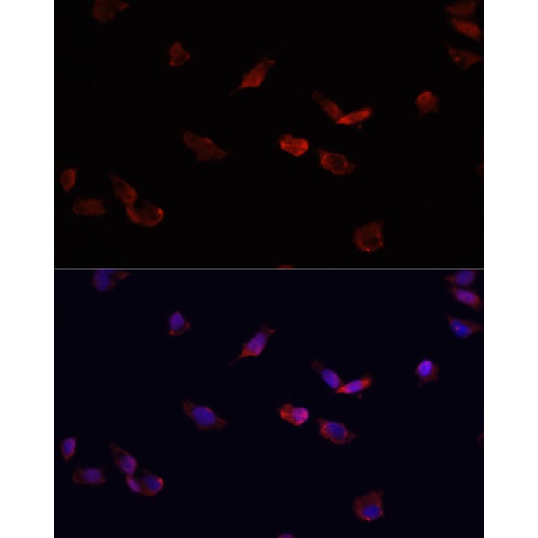 Immunofluorescence - Anti-BMPR2 Antibody (A14894) - Antibodies.com