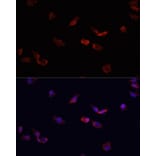 Immunofluorescence - Anti-BMPR2 Antibody (A14894) - Antibodies.com