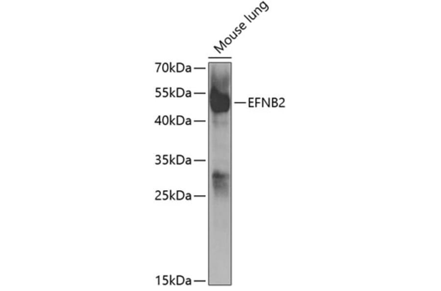 Western Blot - Anti-EFNB2 Antibody (A5669) - Antibodies.com