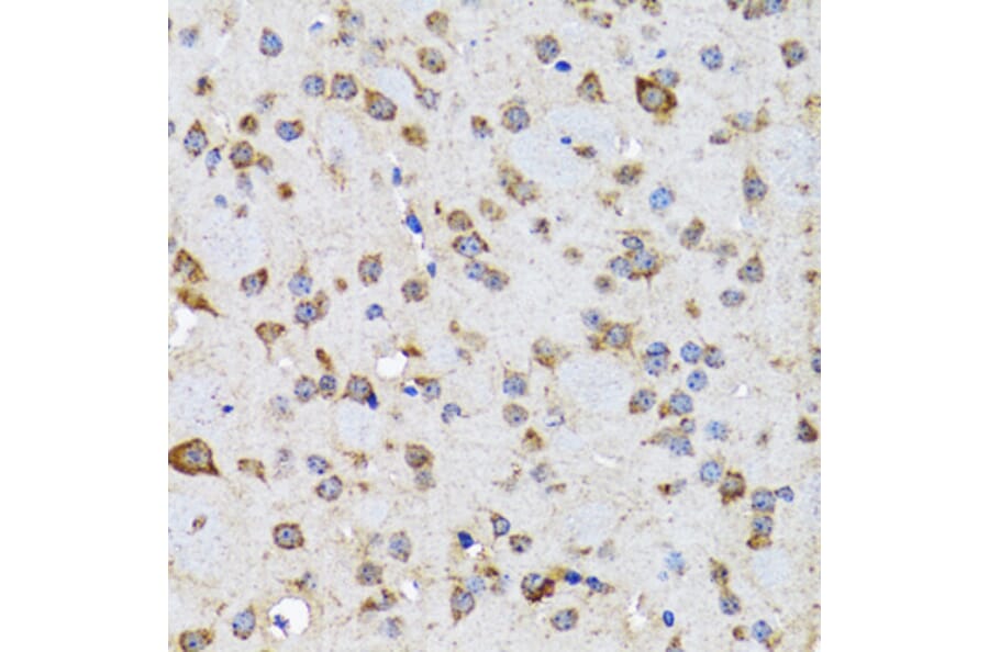 Immunohistochemistry - Anti-EFNB2 Antibody (A5669) - Antibodies.com