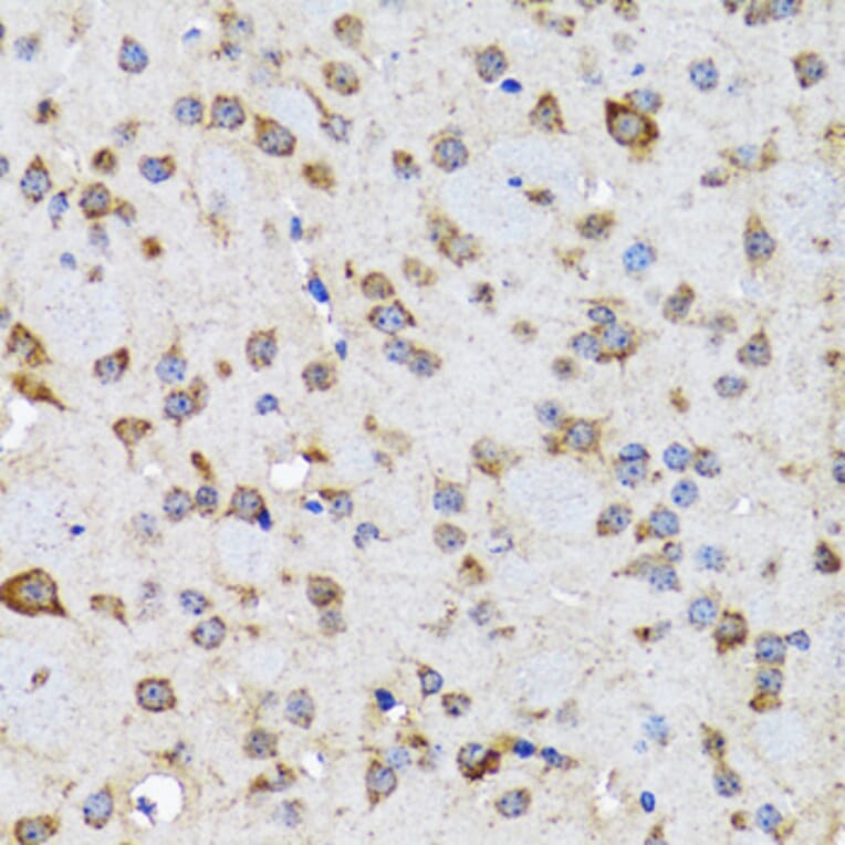 Immunohistochemistry - Anti-EFNB2 Antibody (A5669) - Antibodies.com