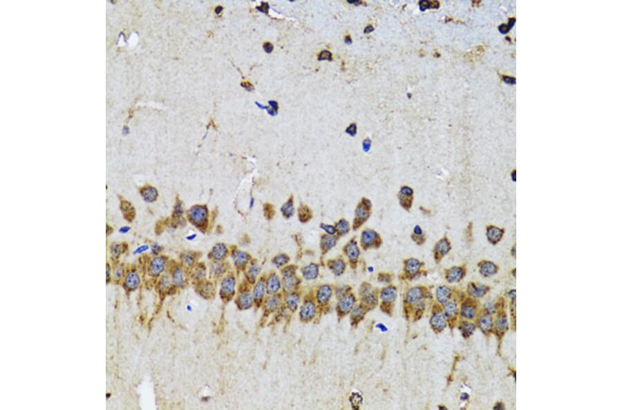 Immunohistochemistry - Anti-EFNB2 Antibody (A5669) - Antibodies.com