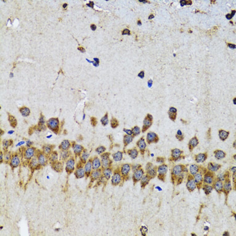 Immunohistochemistry - Anti-EFNB2 Antibody (A5669) - Antibodies.com