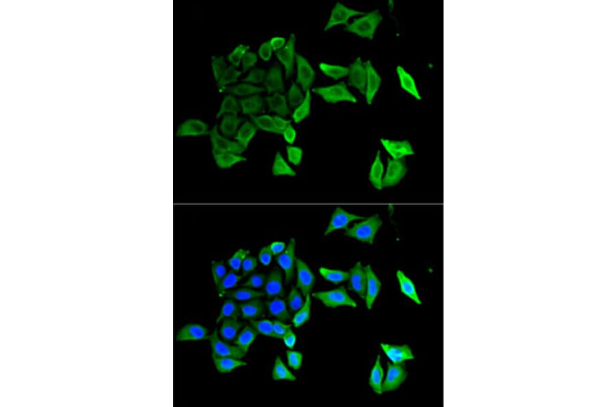 Immunofluorescence - Anti-EFNB2 Antibody (A5669) - Antibodies.com