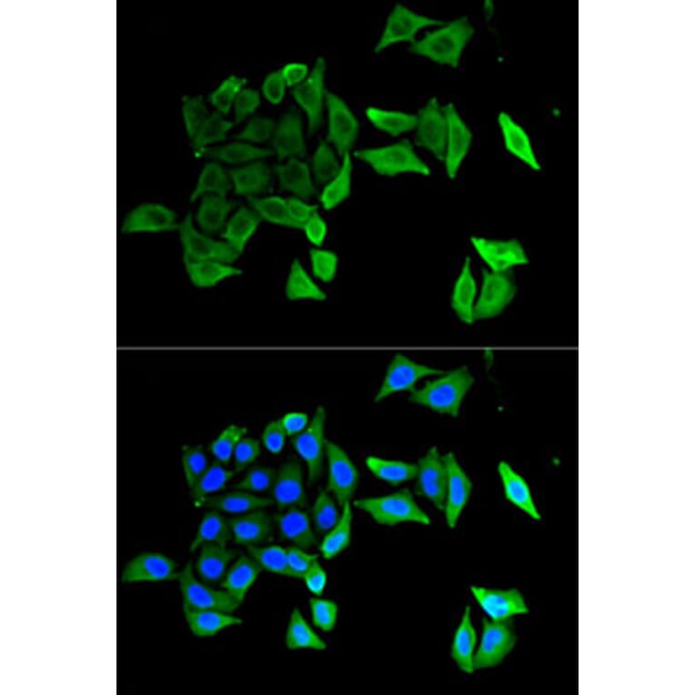 Immunofluorescence - Anti-EFNB2 Antibody (A5669) - Antibodies.com