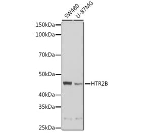 Western Blot - Anti-5-HT-2B Antibody (A14896) - Antibodies.com