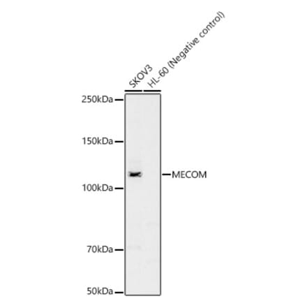 Western Blot - Anti-EVI1 Antibody (A14897) - Antibodies.com