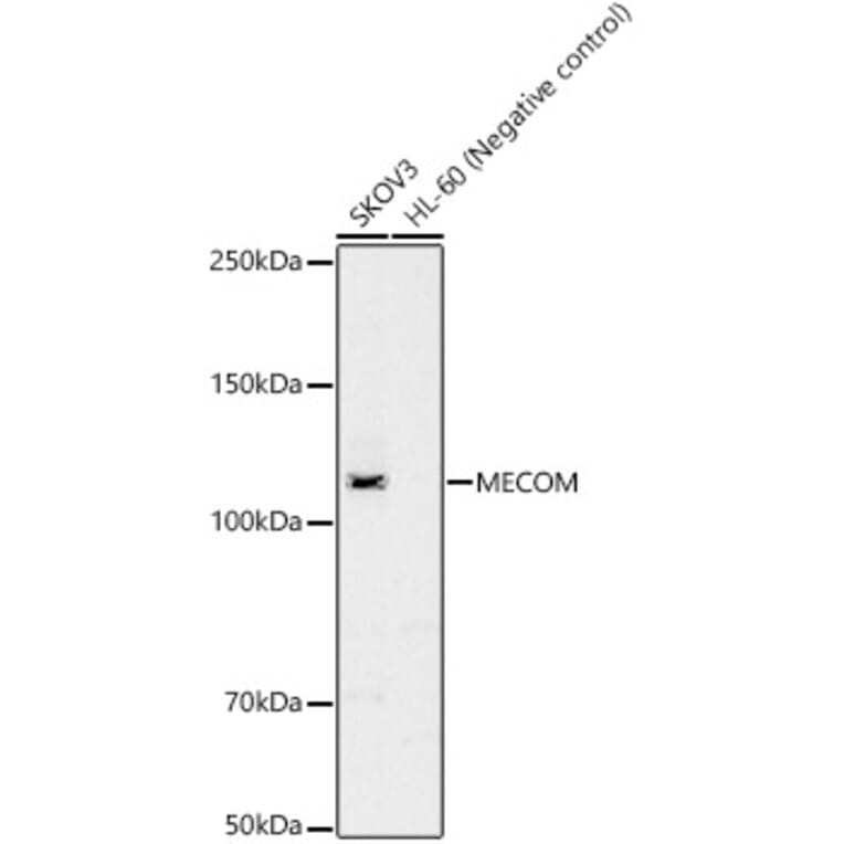 Western Blot - Anti-EVI1 Antibody (A14897) - Antibodies.com