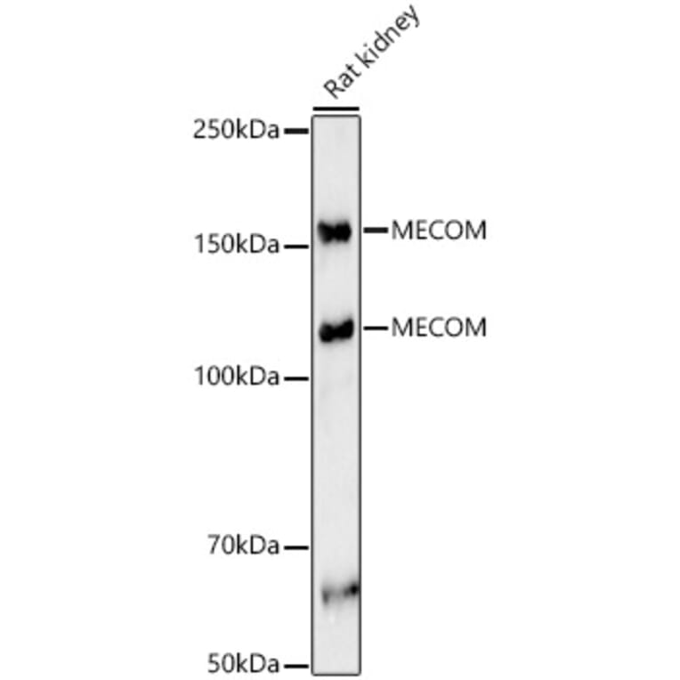 Western Blot - Anti-EVI1 Antibody (A14897) - Antibodies.com