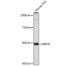 Western Blot - Anti-RBPJK Antibody (A14898) - Antibodies.com