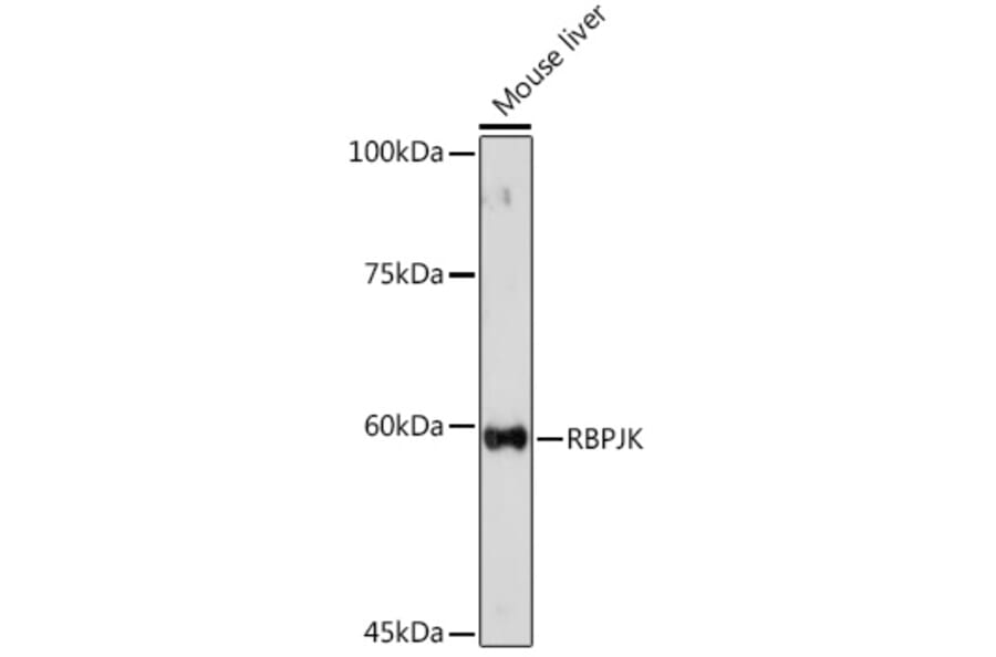 Western Blot - Anti-RBPJK Antibody (A14898) - Antibodies.com