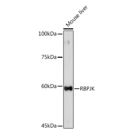 Western Blot - Anti-RBPJK Antibody (A14898) - Antibodies.com