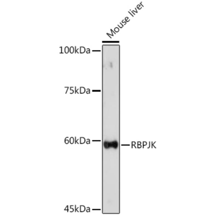 Western Blot - Anti-RBPJK Antibody (A14898) - Antibodies.com