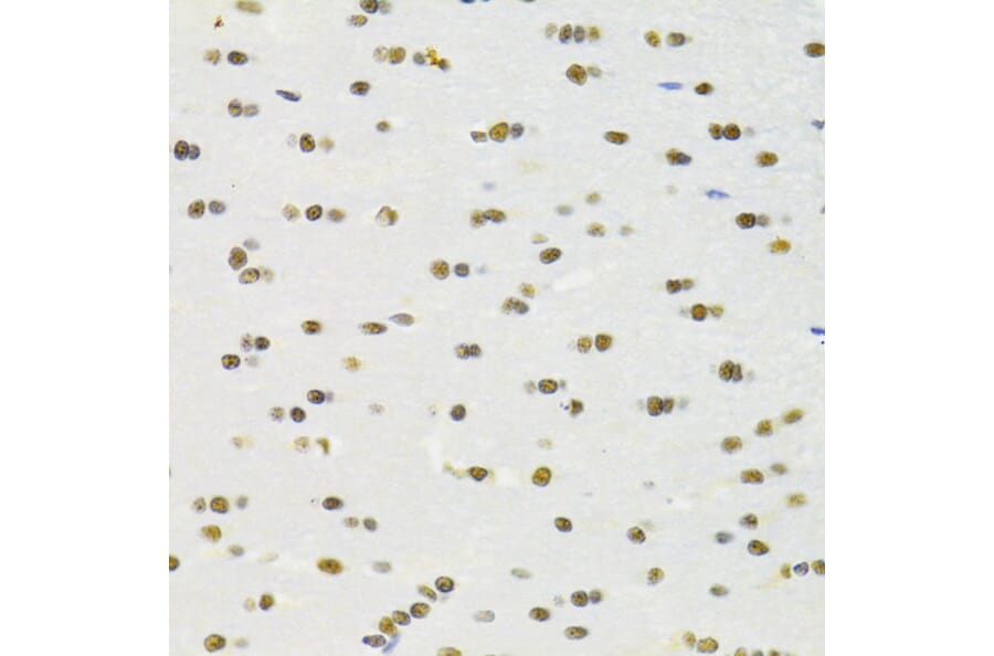 Immunohistochemistry - Anti-RBPJK Antibody (A14898) - Antibodies.com