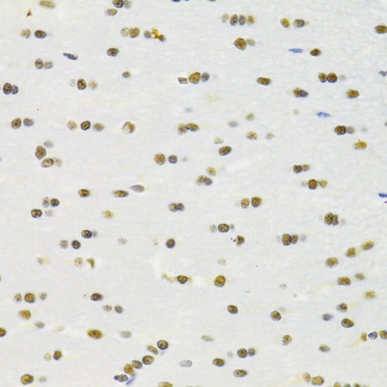 Immunohistochemistry - Anti-RBPJK Antibody (A14898) - Antibodies.com