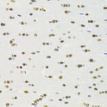 Immunohistochemistry - Anti-RBPJK Antibody (A14898) - Antibodies.com