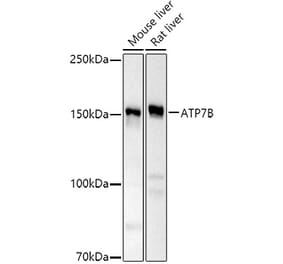 Western Blot - Anti-ATP7b Antibody (A14899) - Antibodies.com