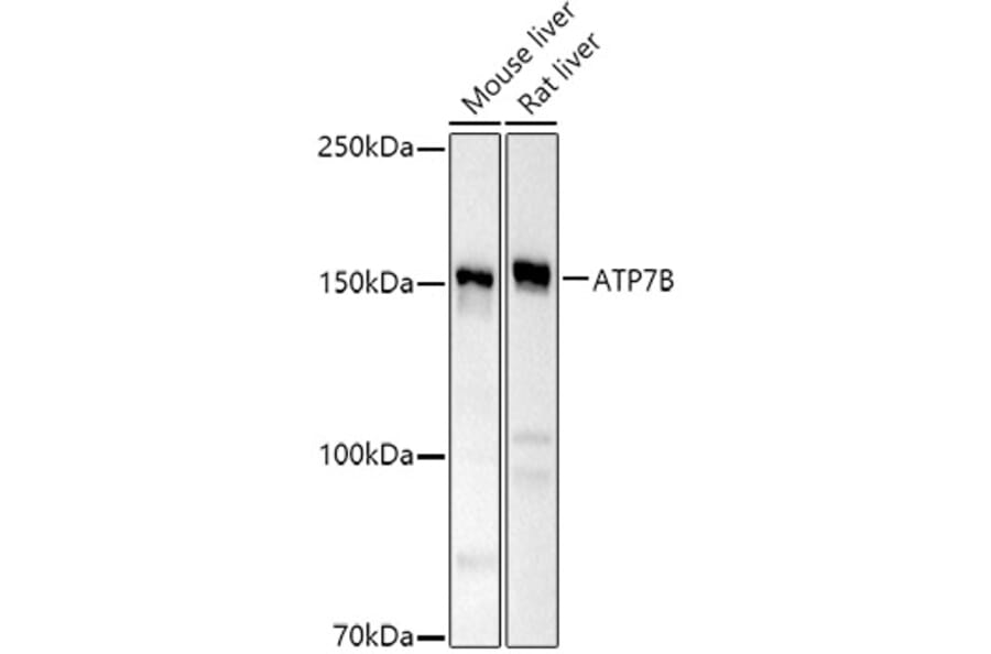 Western Blot - Anti-ATP7b Antibody (A14899) - Antibodies.com