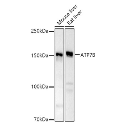 Western Blot - Anti-ATP7b Antibody (A14899) - Antibodies.com