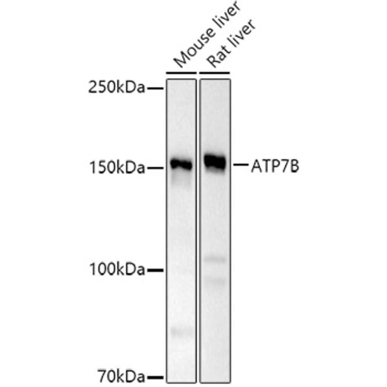 Western Blot - Anti-ATP7b Antibody (A14899) - Antibodies.com