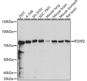 Western Blot - Anti-FOXP2 Antibody (A14900) - Antibodies.com
