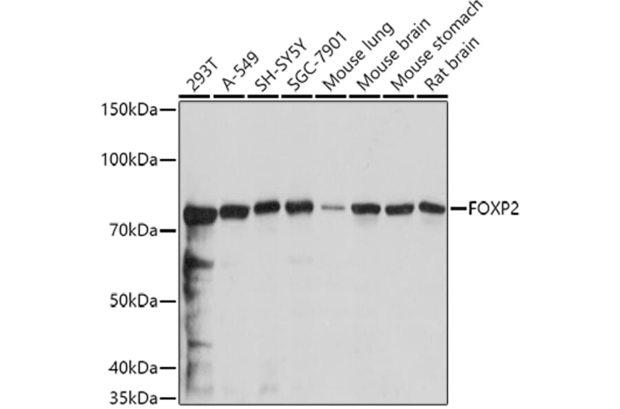 Western Blot - Anti-FOXP2 Antibody (A14900) - Antibodies.com