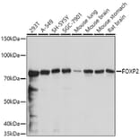Western Blot - Anti-FOXP2 Antibody (A14900) - Antibodies.com