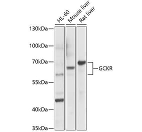 Western Blot - Anti-GCKR Antibody (A14901) - Antibodies.com