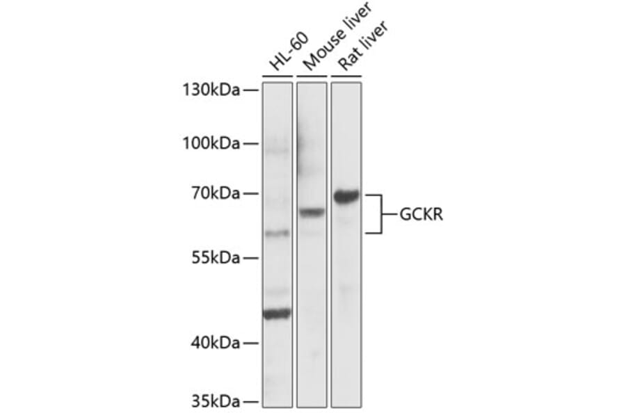 Western Blot - Anti-GCKR Antibody (A14901) - Antibodies.com