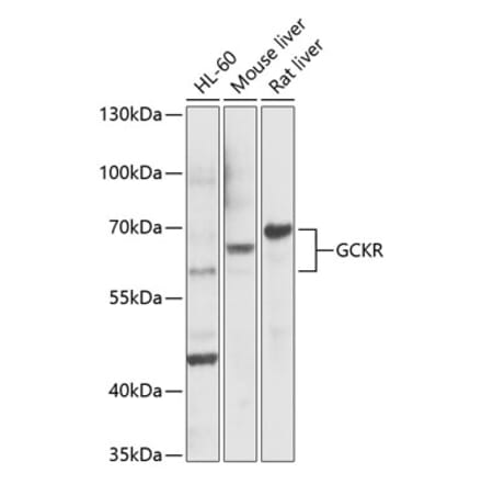 Western Blot - Anti-GCKR Antibody (A14901) - Antibodies.com