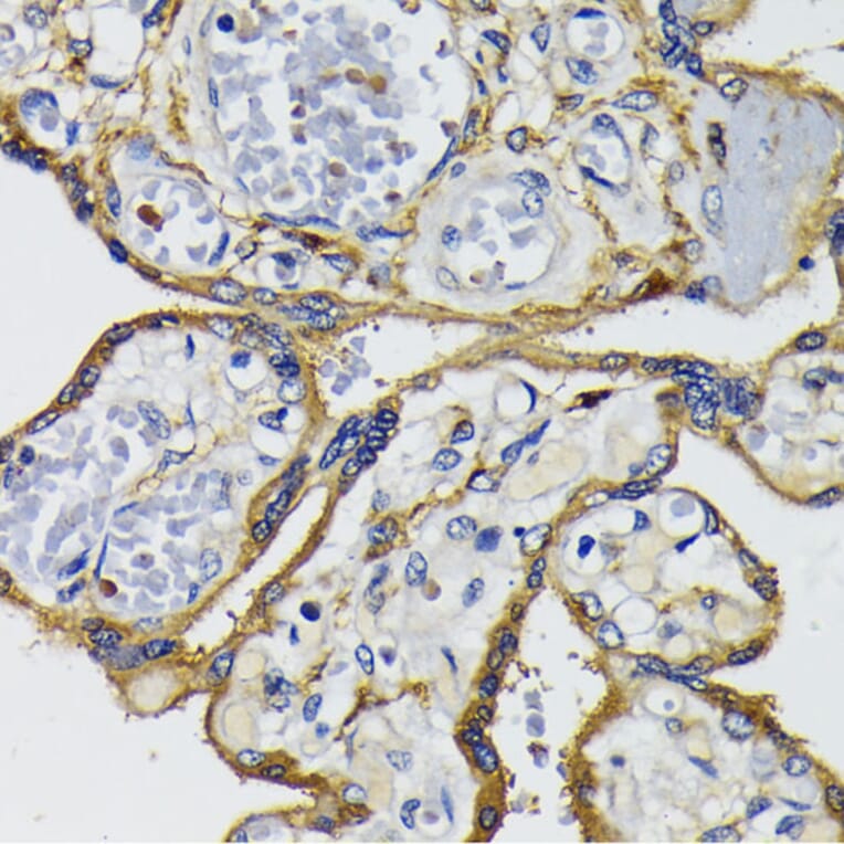 Immunohistochemistry - Anti-IQGAP1 Antibody (A14902) - Antibodies.com