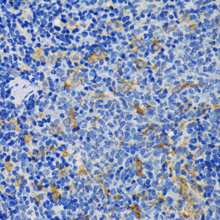 Immunohistochemistry - Anti-IQGAP1 Antibody (A14902) - Antibodies.com